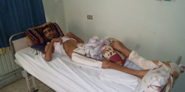 mohamed hanchi belessé de la révolution